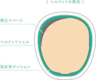 アイメットの原理