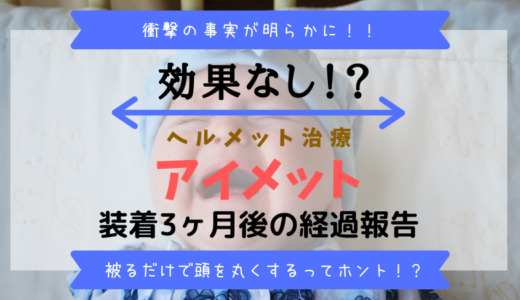 絶壁頭だとはげる 薄毛対策は早めの生活改善がカギ きらりーん